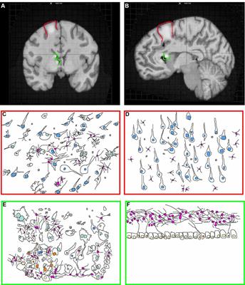 The Neurodevelopmental Pathogenesis of Tuberous Sclerosis Complex (TSC)